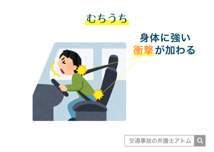 むちうち