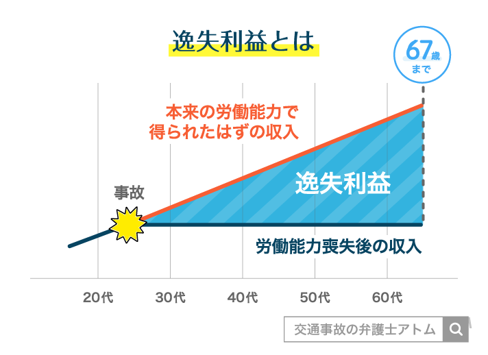 逸失利益とは