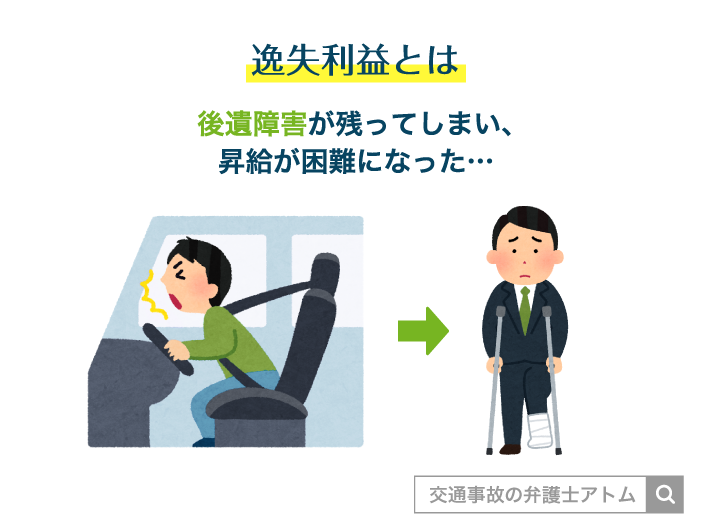 逸失利益とは