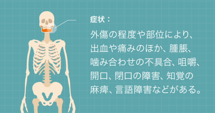 顎骨骨折の症状：外傷の程度や部位により、出血や痛みのほか、腫脹、噛み合わせの不具合、咀嚼開口、開口の障害、知覚の麻痺、言語障害などがある。