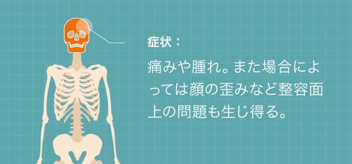 顔面骨折の症状：痛みや腫れ。また場合によっては顔の歪みなど整容面上の問題も生じ得る。