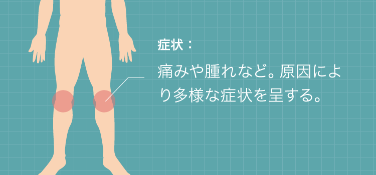 膝の痛みの症状：痛みや腫れなど。原因により多様な症状を呈する。