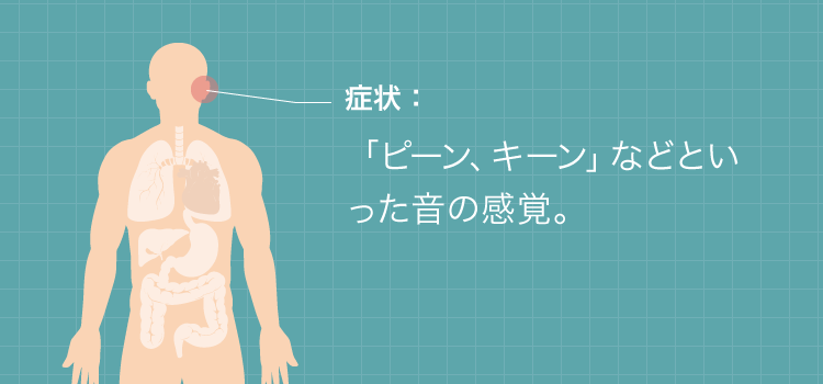 耳鳴りの症：「ピーン、キーン」などといった音の感覚。