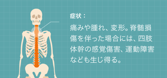 脊椎圧迫骨折の症状：痛みや腫れ、変形。脊髄損傷を伴った場合には、四肢体幹の感覚障害、運動障害なども生じ得る。