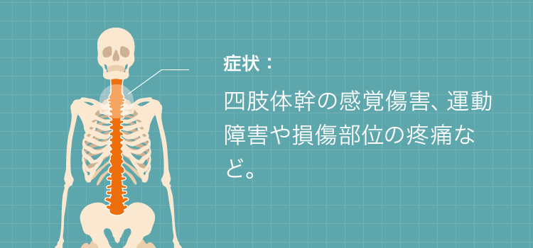 脊髄損傷の症状と部位の図解