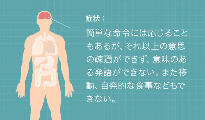 遷延性意識障害の症状：簡単な命令には応じることもあるが、それ以上の意思の疎通ができず、意味のある発語ができない。また移動、自発的な食事などもできない。