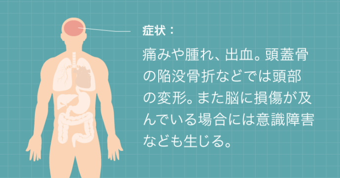 頭部外傷の症状：痛みや腫れ、出血。頭蓋骨の陥没骨折などでは頭部の変形。また脳に損傷が及んでいる場合には意識障害なども生じる。