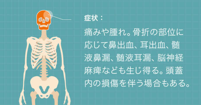 頭蓋骨骨折の症状：痛みや腫れ。骨折の部位に応じて鼻出血、耳出血、髄液鼻漏、髄液耳漏、脳神経麻痺なども生じ得る。頭蓋骨の損傷を伴う場合もある。