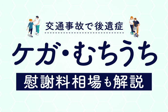 ケガ・むちうちが完治しないと後遺障害?慰謝料相場も解説