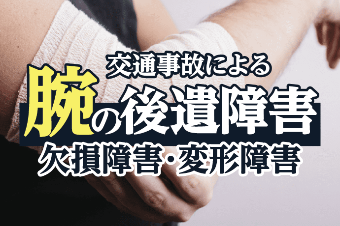 腕の欠損障害、変形障害(偽関節・癒合不全)について解説|後遺障害の認定基準、慰謝料相場とは?