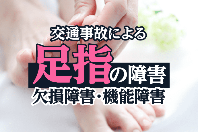 交通事故による足指の障害について解説|欠損障害、機能障害の後遺障害認定基準とは?