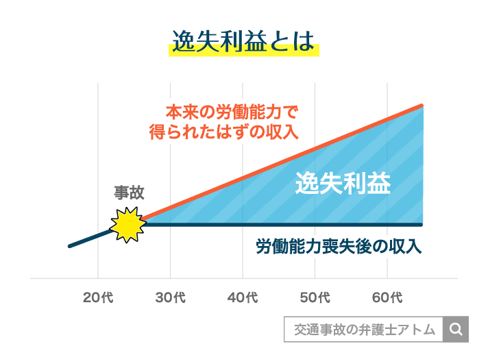 逸失利益とは、後遺障害によって失われた本来の労働能力で得られたはずの収入を補償するもの
